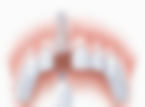 13岁儿童牙齿矫正用什么材质最好？传统金属、陶瓷、隐形等各有优劣，按需选才是关键！ 