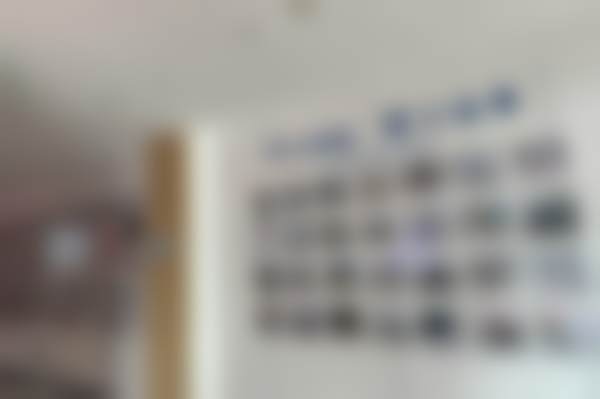 西宁中诺口腔医院根管治疗前磨牙680元起，含补牙拍片，全科医师操作效果好 