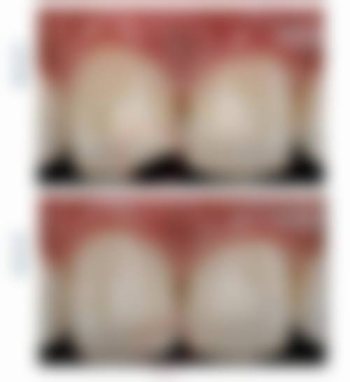 四、深圳御龙云景口腔门诊部特色项目