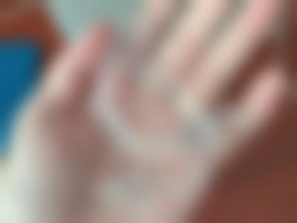 拔牙属于医保报销范围吗？不同地区、保险类型规定不同，拔牙前了解报销规则很重要！ 