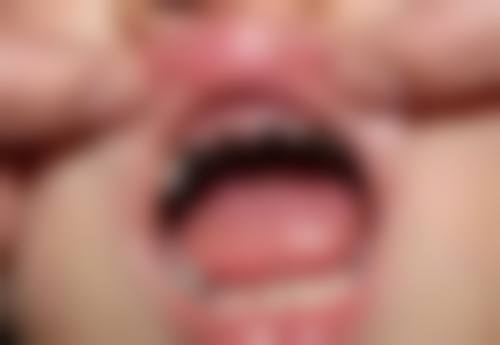 宝宝不配合补牙怎么办？选择合适的时间和环境特别重要