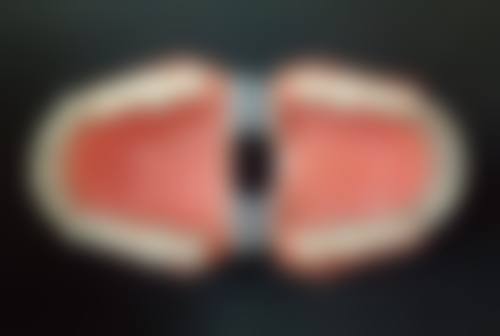 五、昆山萌牙客刘亚医生技术怎么样？