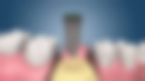 四、昆山萌牙客刘亚医生坐诊医院