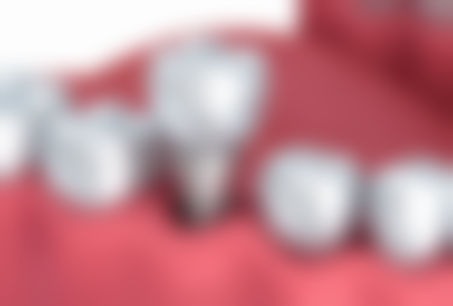 八、重庆皇仕德亚口腔门诊部怎么预约？