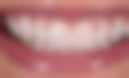 四、湖南郴州市陈国平口腔特色项目