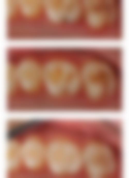 二、海口微笑口腔(陈新门诊部)正规吗？来看医院资质信息