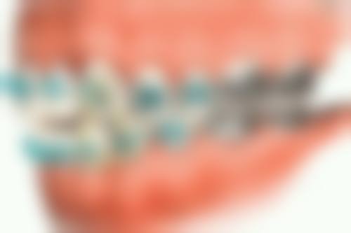 六、广西崇左宁明钰齿口腔口碑如何？