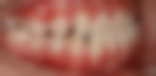 治疗操作规范轻柔