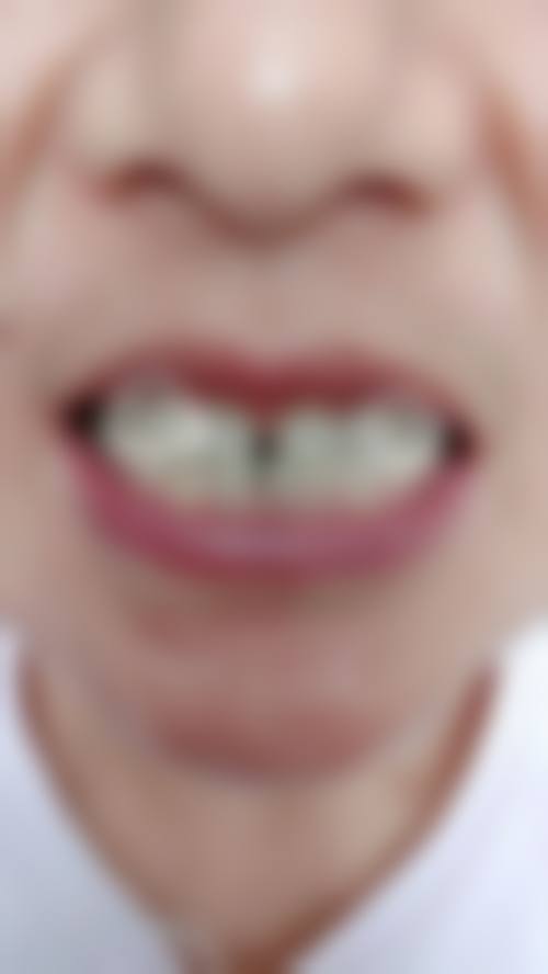 八、深圳禾贝口腔(沙嘴店)怎么预约？