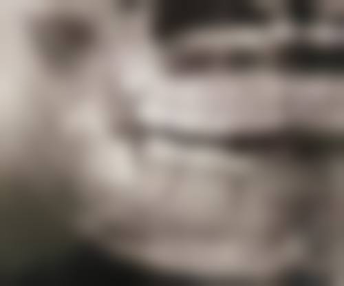 五、长沙吴伟口腔收费价格表