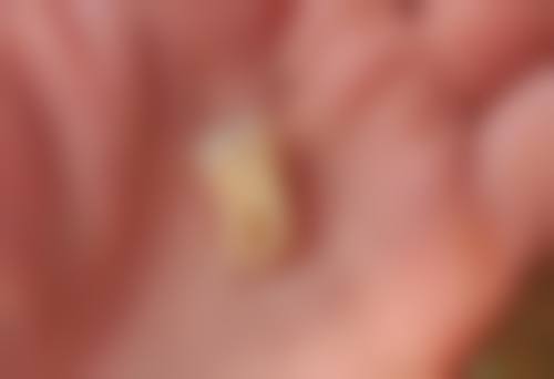 拔牙后吃什么流食有营养的？鸡蛋羹、鱼糜汤等富含蛋白，蔬果流食补维，助伤口愈合！ 