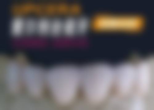 烤瓷牙掉了一块还能粘上吗？这得看基牙和烤瓷牙状况，不同情况处理方式大不同！ 