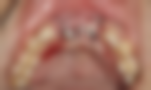 四、江西宜春袁州余学玲口腔特色项目