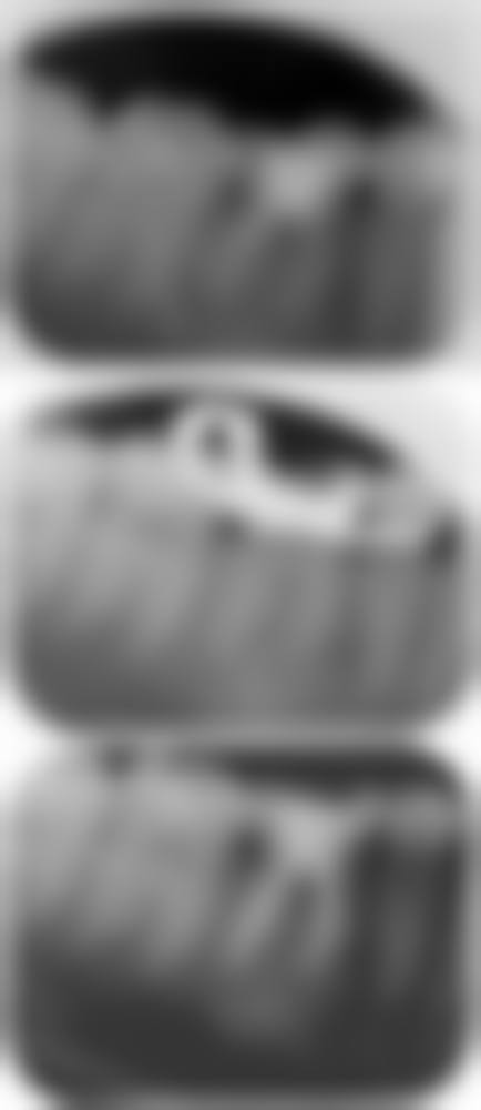 三、江西宜春袁州余学玲口腔医生介绍