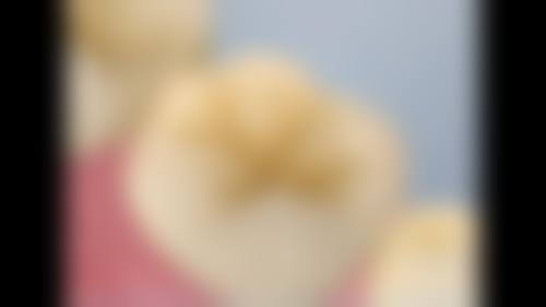 四、徐州赛尔口腔门诊部特色项目