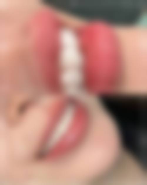 五、安徽宿州东方口腔收费价格表