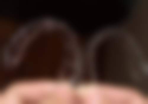 四、嘉兴牙博士口腔门诊部(嘉兴城东机构)特色项目