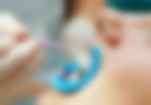 影响用患侧吃东西时间的因素