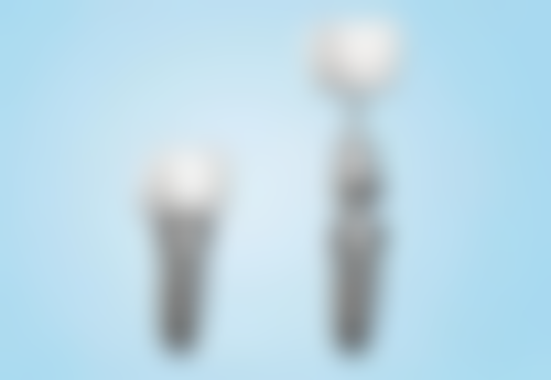 选择nobel种植牙的注意事项