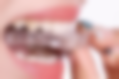 身体状况对拔牙的影响