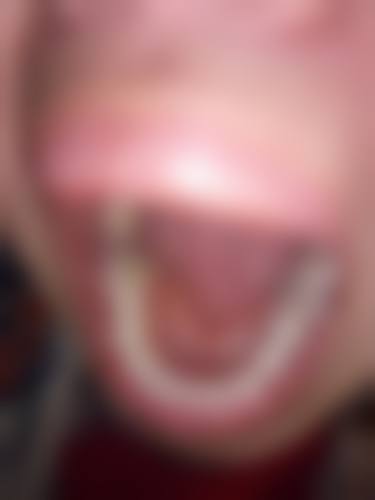 八、赣州芽乐乐口腔怎么预约？