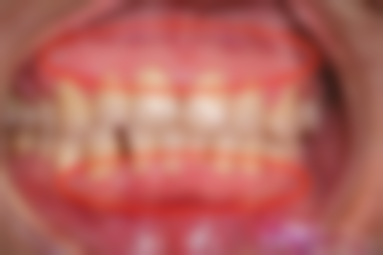 ARNOLDMATTHIAS医生口碑评价及真人实例反馈