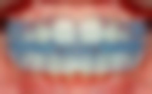 六、泉州齐植美口腔门诊部口碑如何？