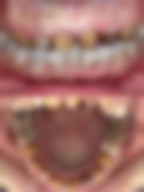 六、惠州精峰口腔门诊部口碑如何?