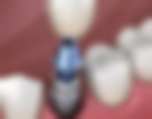 六、南京维尔建口腔门诊部(大厂分院)口碑如何？