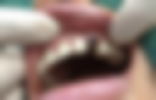 五、隆尧魏建伟口腔收费价格表