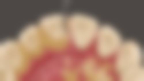 六、深圳健康齿科(长圳二分店)口碑如何?