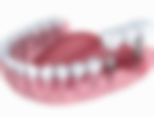 四、杭州维佳康口腔湖墅南路诊所特色项目