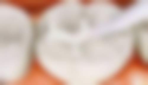 六、东莞市洁佳口腔口碑如何？