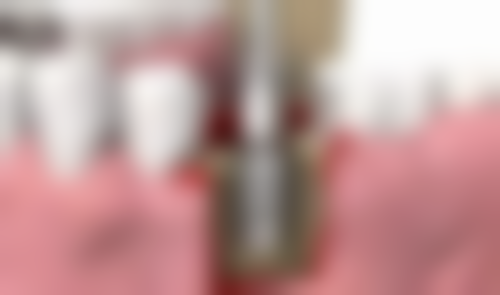 四、河南漯河洁雅口腔门诊部特色项目