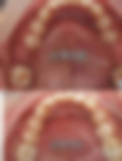 四、开封植得口腔医院特色项目