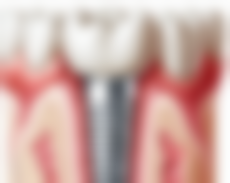 四、长春雅贝嘉口腔门诊部(超凡四店)特色项目