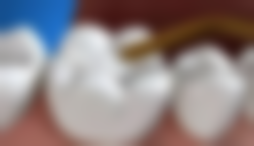 六、江苏南京桑庆南口腔口碑如何？