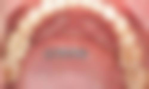 八、重庆浩美口腔怎么预约?