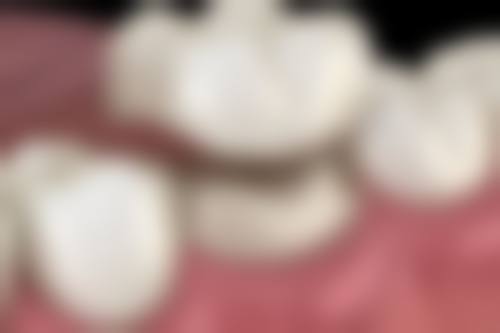 提前预约的优势