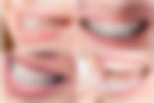 北京京大博爱口腔门诊部舌侧矫正（上舌下唇）之硕博团队优势