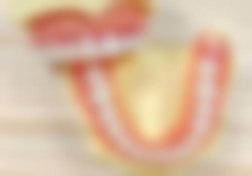 抽牙神经再补牙是根管治疗吗？其实抽牙神经只是第一步，完整流程后才可补牙！ 