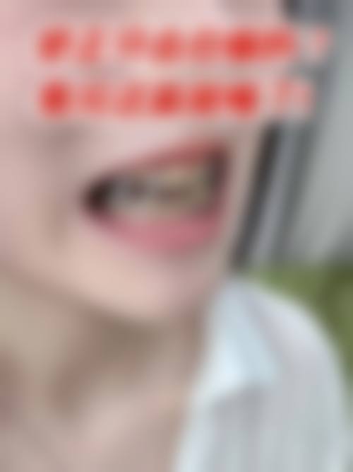 六、山东济南诺瓦口腔门诊口碑如何？