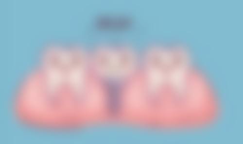 国产非自锁金属托槽矫正的流程