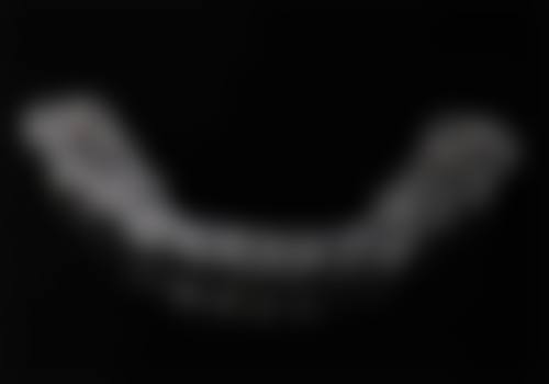 四、义乌嘉和口腔特色项目