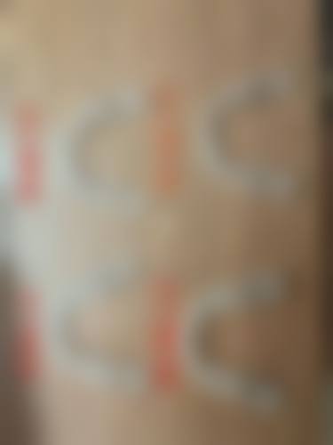 如何选择打桩还是种植牙