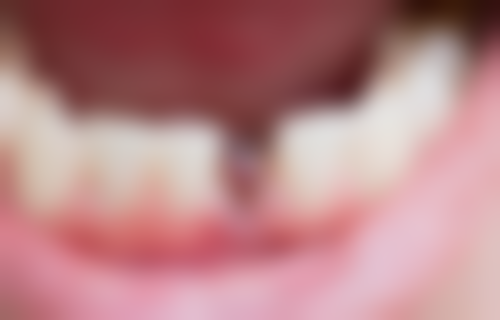 八、广东东莞爱雅仕口腔门诊部怎么预约？