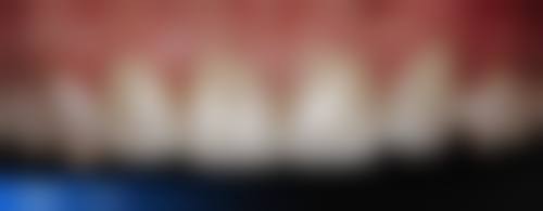 五、济南市中爱德口腔收费价格表