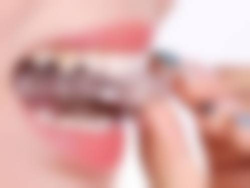 五、深圳吴雁芬口腔诊所(吴凯口腔)收费价格表