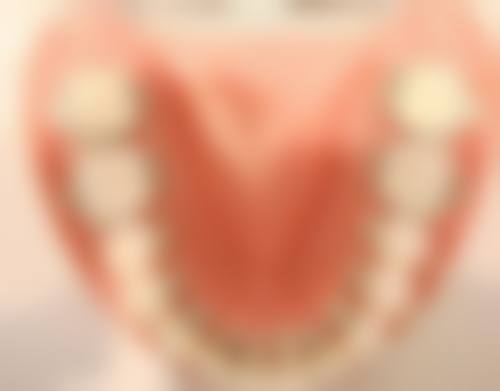 掉一半的牙齿补牙怎么补？需依具体情况选树脂充填、嵌体修复等方式，一文为你详解！ 