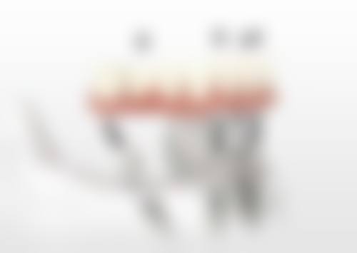 四、重庆合川介寿牙科特色项目